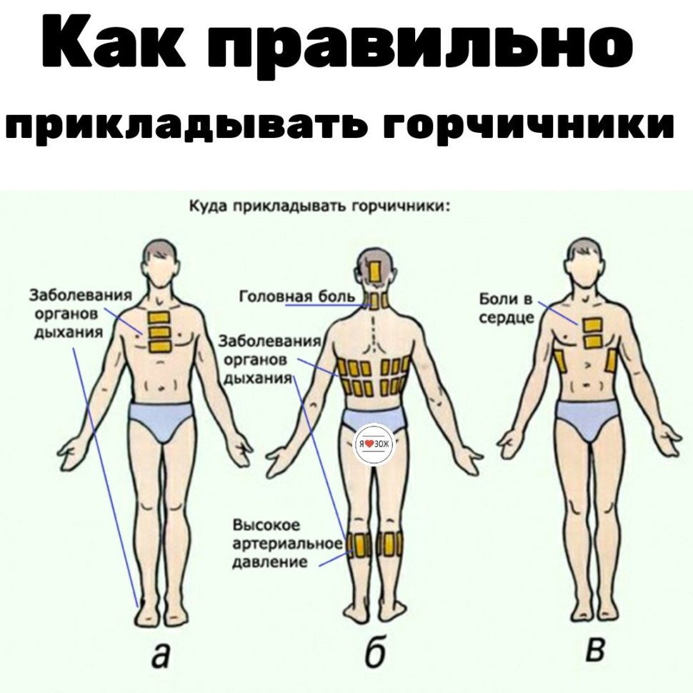 Как правильно ставить горчичники